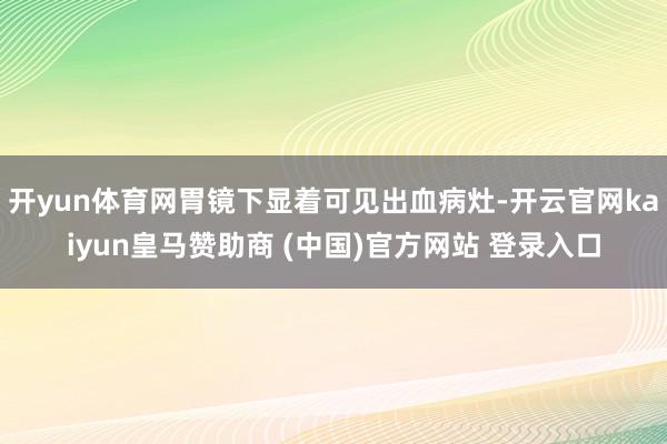 开yun体育网胃镜下显着可见出血病灶-开云官网kaiyun皇马赞助商 (中国)官方网站 登录入口